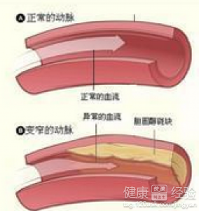 第1步