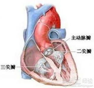 心肌梗死的症狀及表現