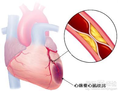 第1步