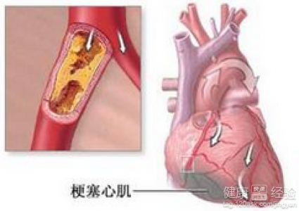 第1步