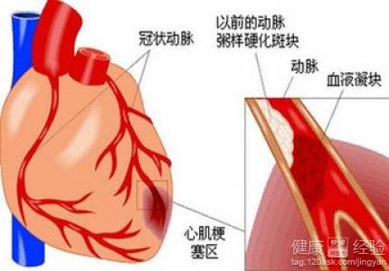 第1步