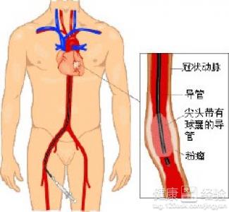 第1步