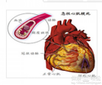 第2步