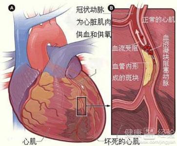 第1步