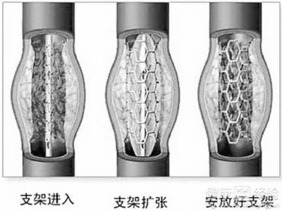 第2步