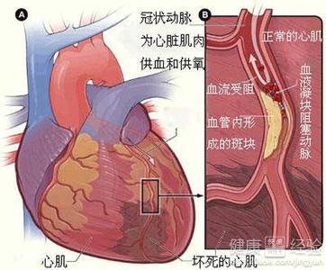 第1步