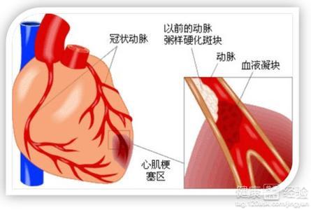 第2步