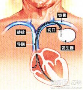 第2步