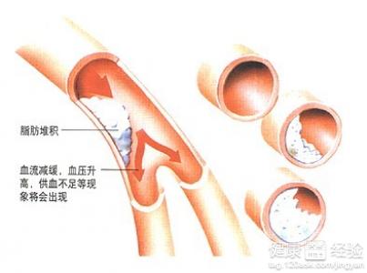 第2步