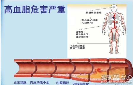 第2步