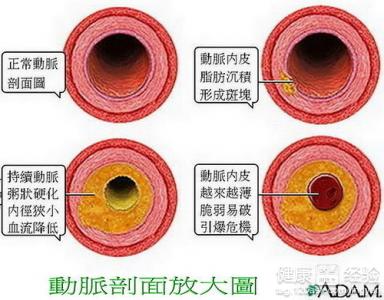 第2步