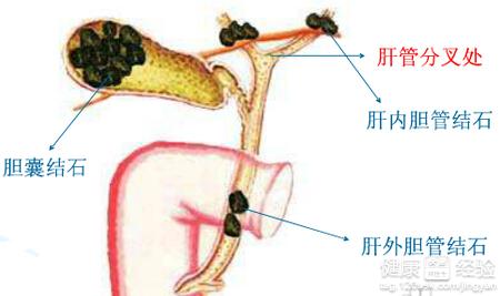 第2步