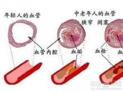 長期喝咖啡易患心腦血管病喝咖啡注意四禁忌