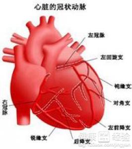 治療冠心病需對症下藥