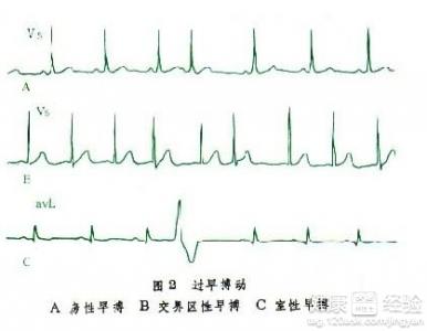 第2步