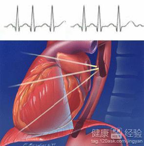 第1步