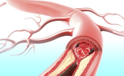 什麼是冠心病 冠心病有什麼危害 冠心病常識