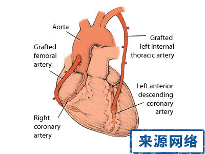 冠心病 心絞痛 治療 藥物