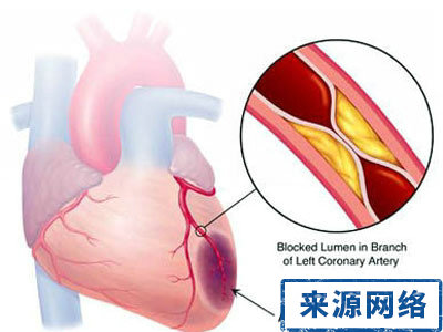 冠心病 心理療法 心理暗示 治療