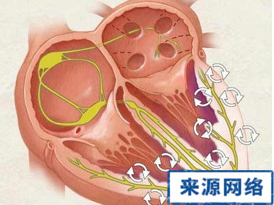 冠心病 基因缺陷 冠心病原因