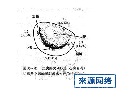 心髒病 心髒手術 心肌梗死 二尖瓣關閉不全