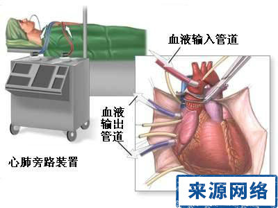 心髒病移植 心髒移植排斥反應