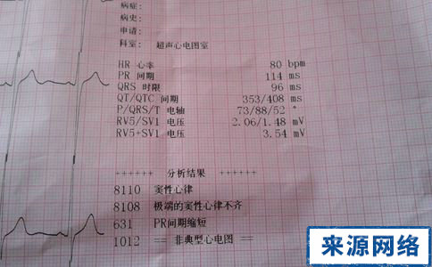 心律不齊有什麼要注意 心律不齊注意什麼 心律不齊怎麼辦